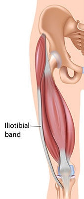 iliotibial band
