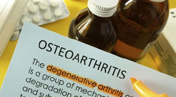 osteoarthritis