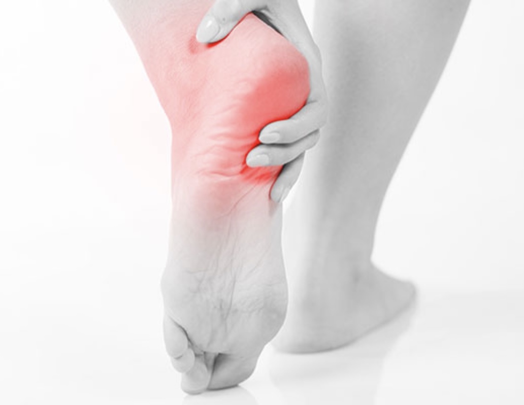 Heel Pain
